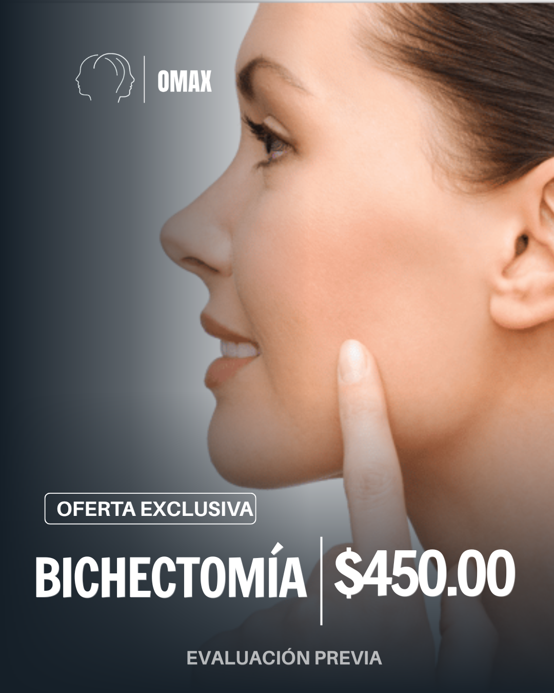 Bichectomía