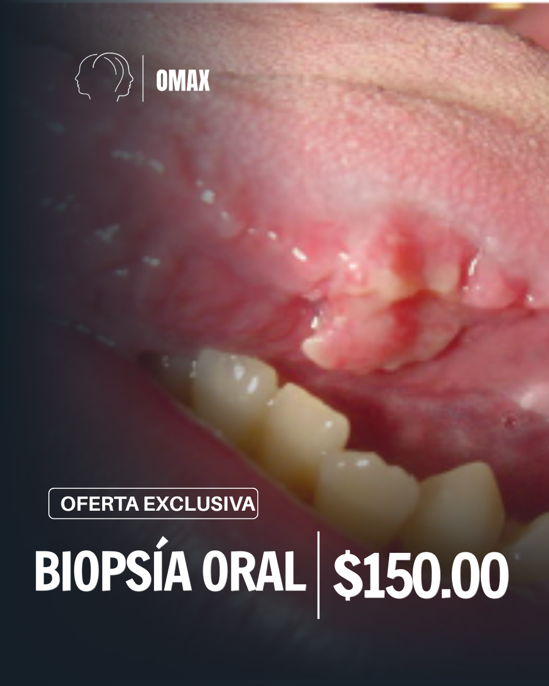 Biopsia oral
